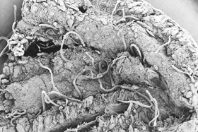 The indiscriminate use of medicated grit will inevitably build resistance